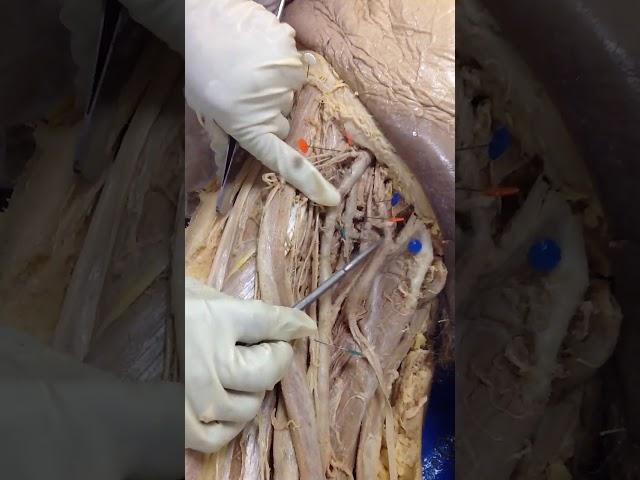 Femoral Artery and Branches dissection of cadaver- human anatomy lab- 1st MBBS