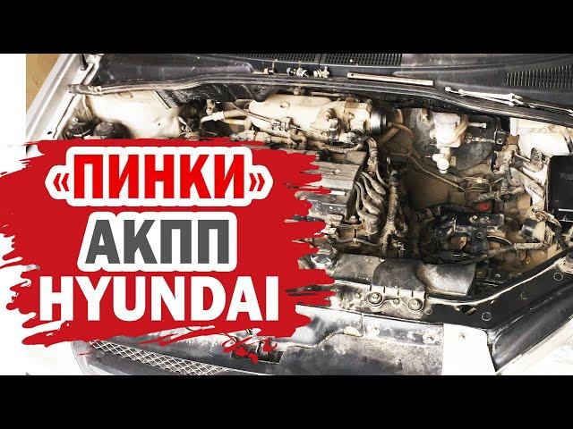 Один из способов устранения рывков при переключении АКПП Hyundai (Хендай)