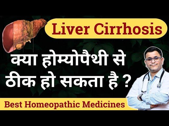 Liver cirrhosis homeopathy treatment Homeopathic medicine for Liver Cirrhosis