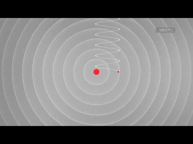 Understanding Sound Waves | MED-EL