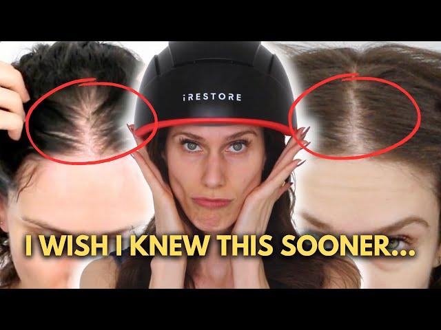 5 Things I Wish I Knew Before Using iRestore Hair Growth Helmet