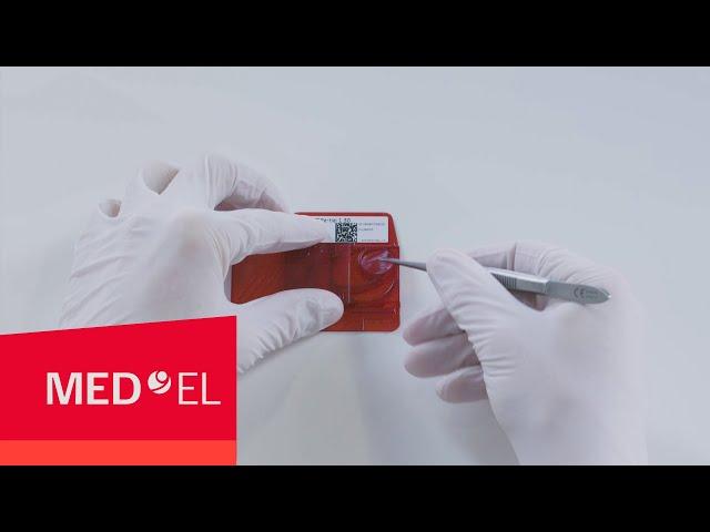 How to Unbox Our Passive Middle Ear Implants | MED-EL