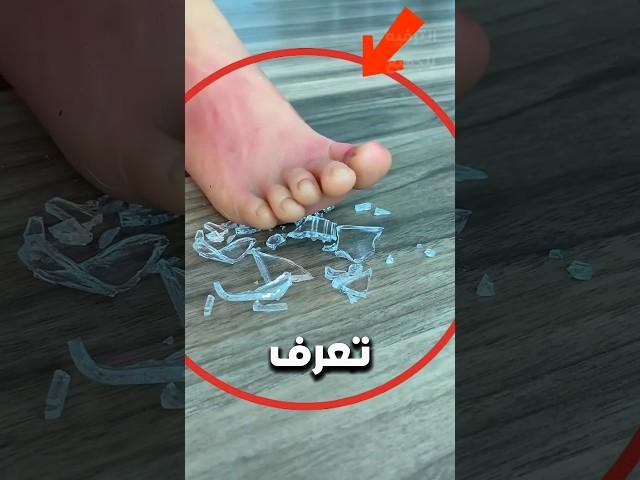 كيف تتصرف إذا دخلت قطعة زجاج في قدمك  ؟!  #شورتس #اكسبلور