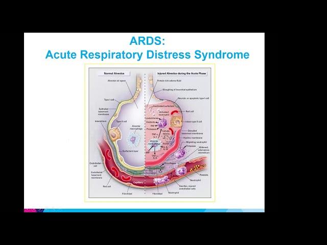 Overview of Critical Care Management of COVID Patients in the ICU by Dr. Bassily-Marcus, MD