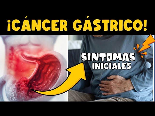 ¡CUIDADO! CÁNCER DE ESTÓMAGO - SÍNTOMAS INICIALES