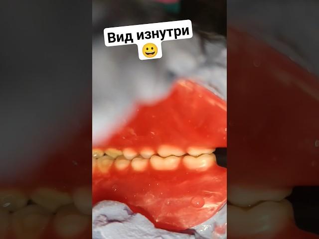 Протез БЕЗ НЁБА! #безнёбасъёмныепротезы #съёмныезубныепротезы #съёмныепротезы