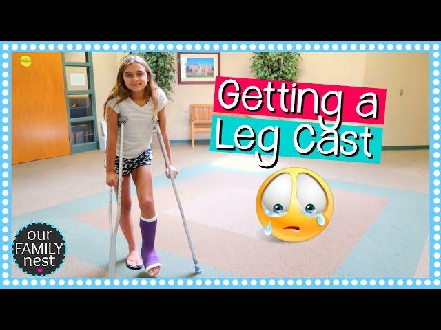 GETTING A LEG CAST FOR BROKEN FOOT | DANCE INJURY