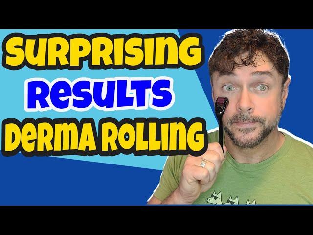 How To Get AMAZING Results With DERMA ROLLER | Chris Gibson