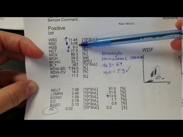 Hematology: How to interpret automated Complete Blood Count (CBC) results