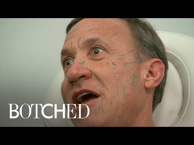 Dr. Terry Dubrow Freaks Out Paul With Face Filler Treatment | Botched | E!