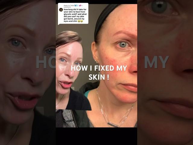 HOW TO FIX a damaged skin barrier  ‼️