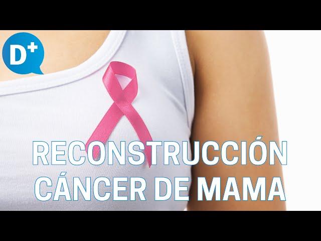 Reconstrucción mamaria para pacientes de cáncer de mama