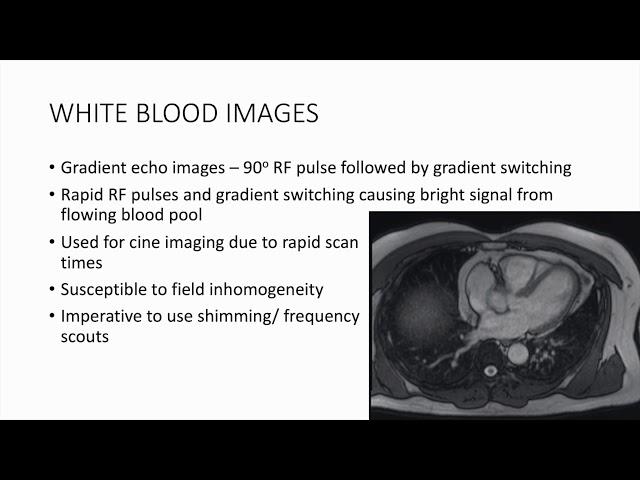 5. CMR Basic Sequences and how to get good images Dr  Pudhiavan