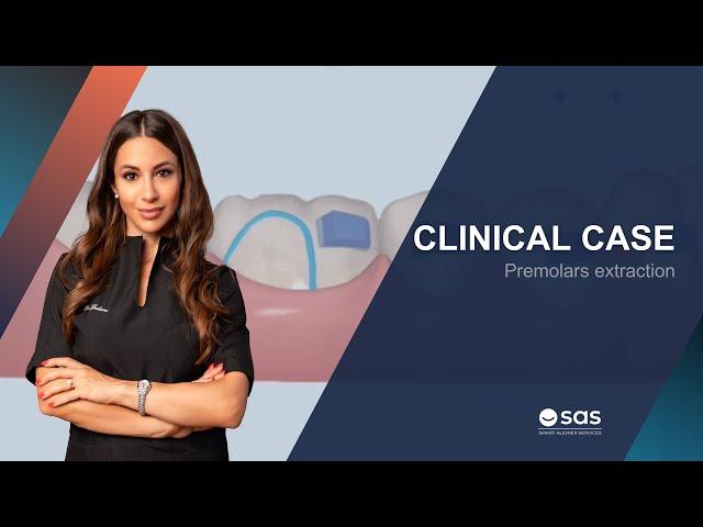 Clinical Case | Premolars extraction - Dr. Lucia Giuliano