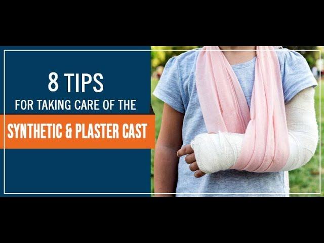 8 Tips for Taking Care of The Synthetic & Plaster Cast