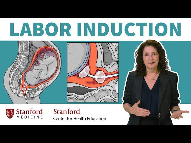 What is labor induction? OB/GYN answers 5 common questions about inducing labor | Stanford