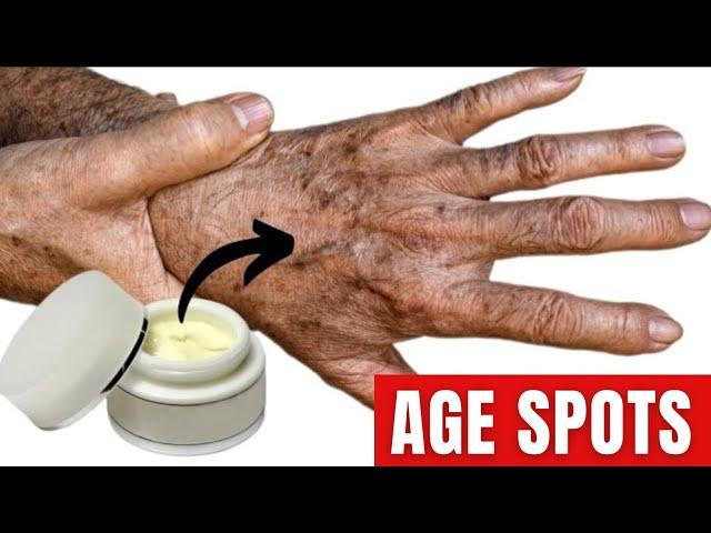 Amazing  Oil Removes AGE SPOTS Forever!