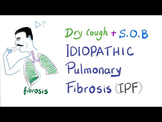 Idiopathic Pulmonary Fibrosis | Restrictive Lung Disease | Pulmonology