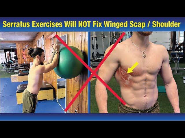 Winged Scapula CAN NOT BE FIXED Doing Serratus Anterior Exercises -(Correct the Problem!)