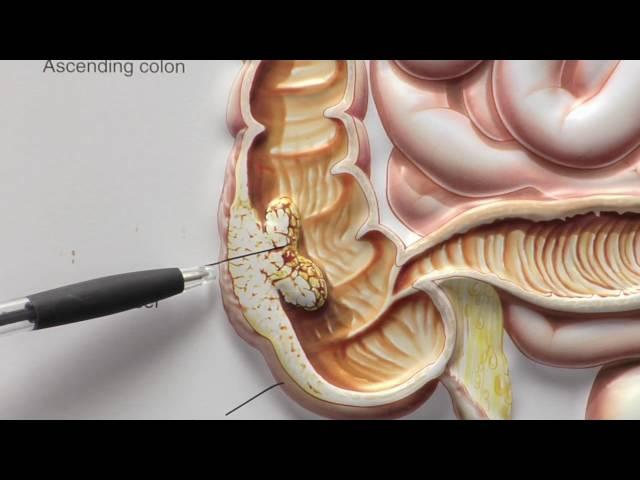 Primary Care | PCP | Annual Checkup | HealthBreak | Arroyo Grande Community Hospital