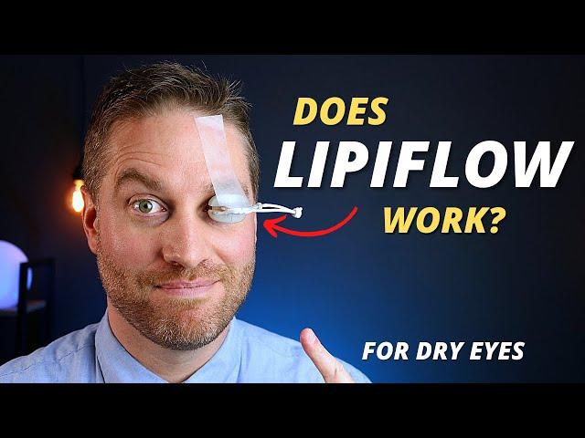 Is Lipiflow Worth It? - Advanced Dry Eye Treatment For Meibomian Gland Dysfunction (MGD)