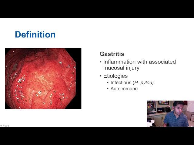 Gastritis vs. Gastropathy