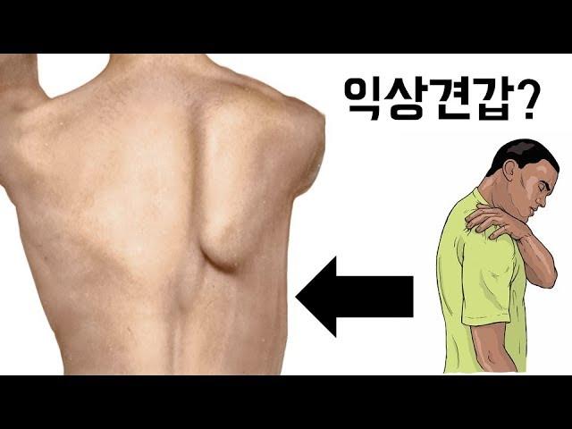 혹시..나도? 어깨가 아픈이유, 해결법 (익상견갑)