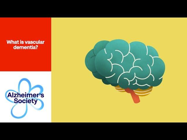 What is vascular dementia?