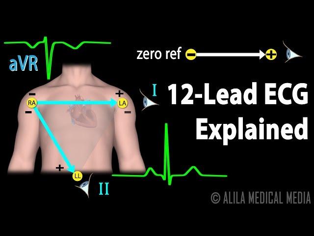 12 Lead ECG Explained, Animation