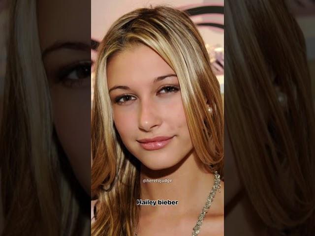 Celebrities extreme plastic surgeries #shorts