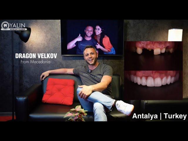 Dental Care in Turkey Antalya | YALIN Dental Clinic #teethturkey #turkeyteeth  #dentiststurkey