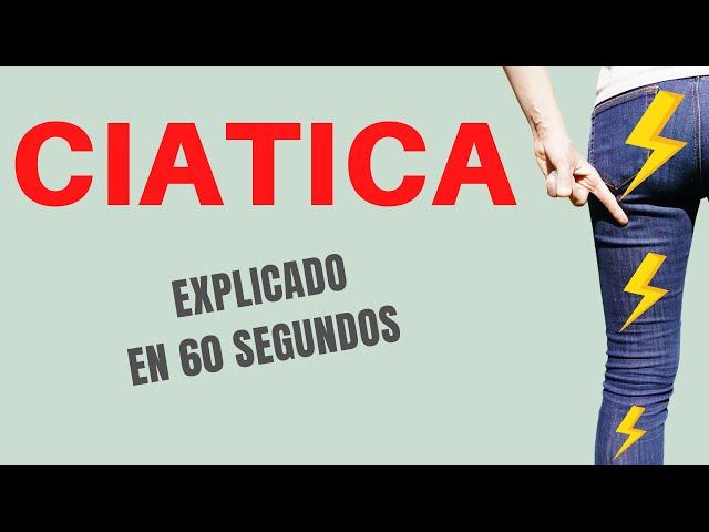 CIATICA (Explicado en 60 Segundos)