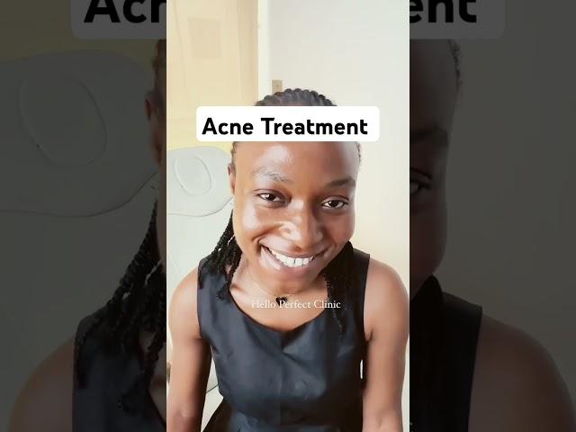 Acne Journey Credits : Perfect clinic via IG #acnejourney  #acnetreatment #acne #pimples