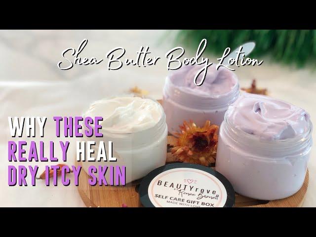 How This SHEA BUTTER LOTION MOISTURIZES & HYDRATES THE SKIN WITHOUT Being GREASY