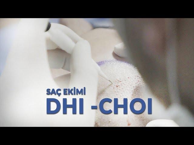 DHI -CHOI Saç Ekimi / 2019