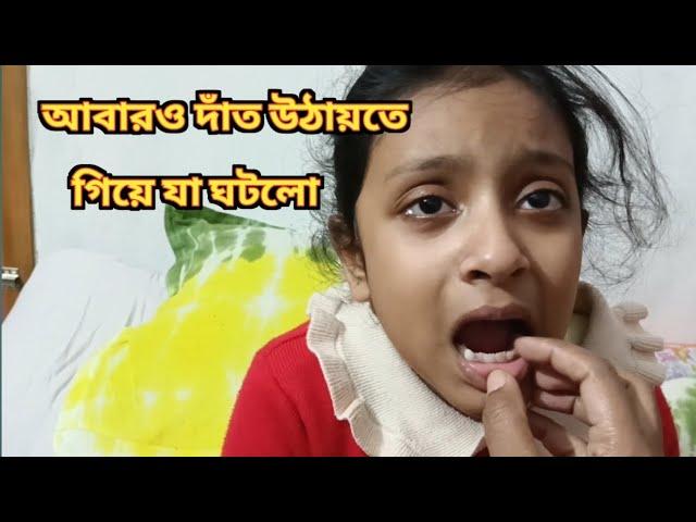 আবারও দাঁত উঠায়তে গিয়ে যা ঘটলো ।What happened while picking up teeth again.