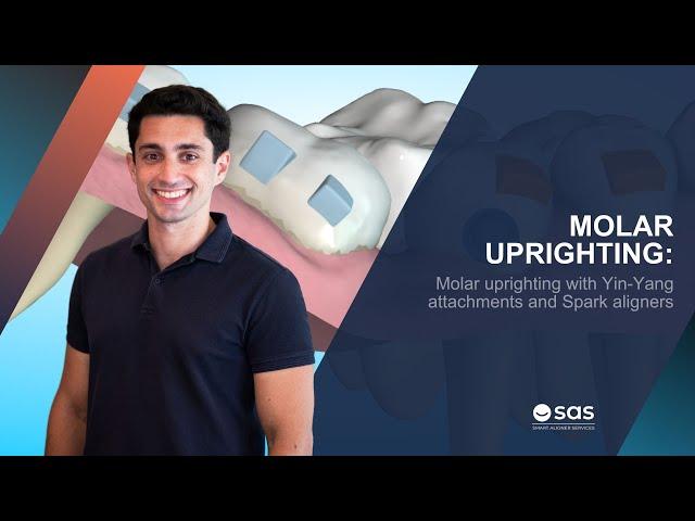 Molar uprighting with Yin-Yang attachments and Spark aligners | SAS