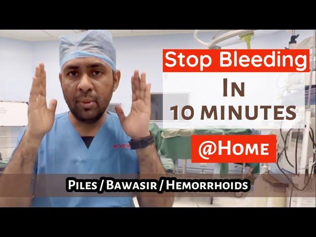 STOP PILES bleeding in 10 minutes ? Quick Cure HEMORRHOIDS BAWASIR in 2 days