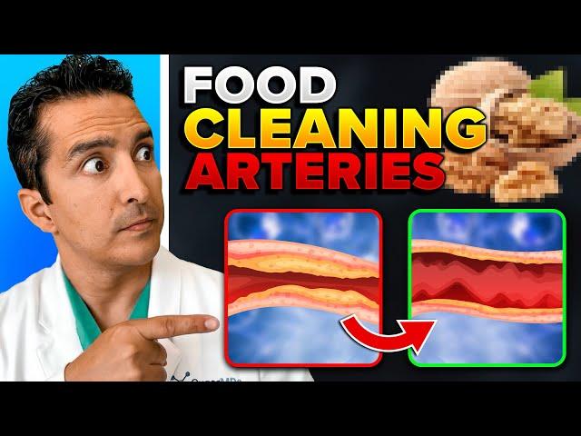 7 Foods That Cleans & Opens Up Arteries For People With Diabetes!