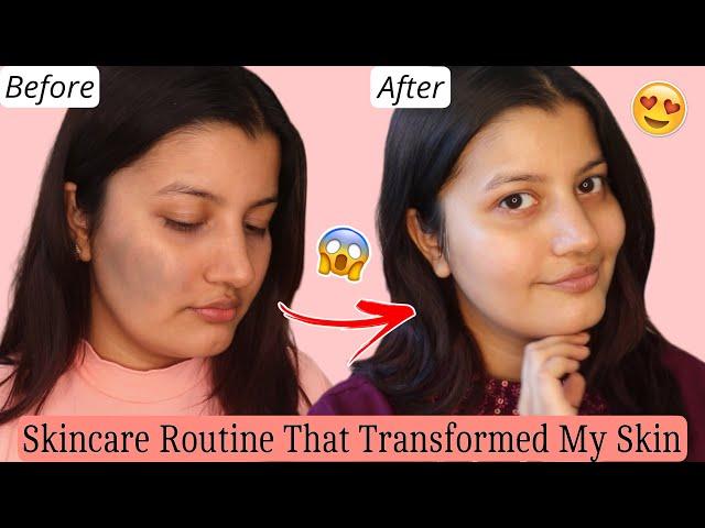 My Skin Transformation | Products & Supplements I Used