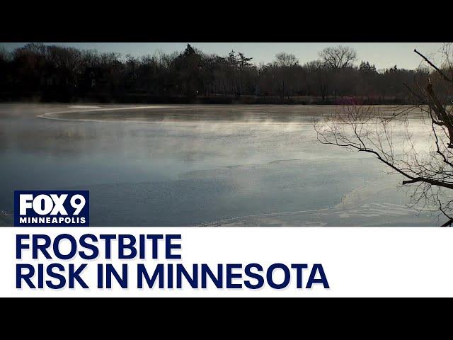 Minnesota health officials warn about frostbite