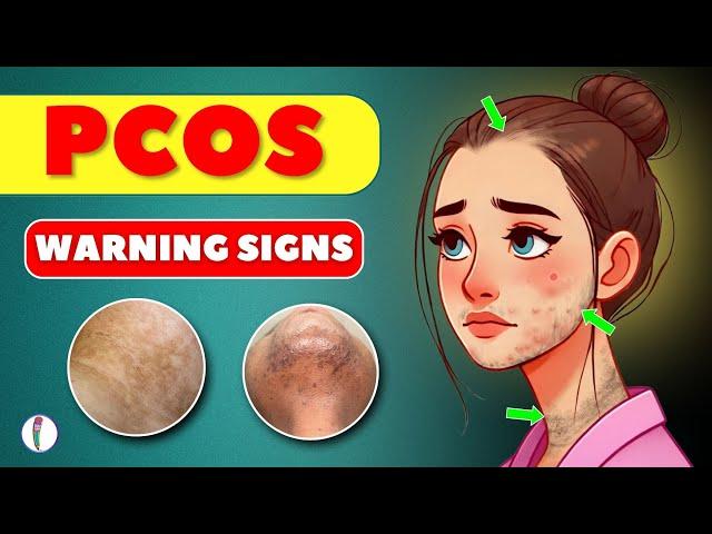 7 Warning signs that you might have PCOS | PCOS Symptoms | PCOD