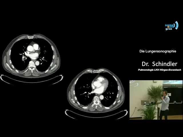 Die Lungensonographie - Dr. Otmar Schindler