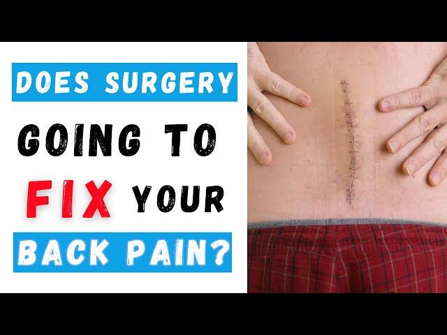 Will surgery alone fix your lower back pain?