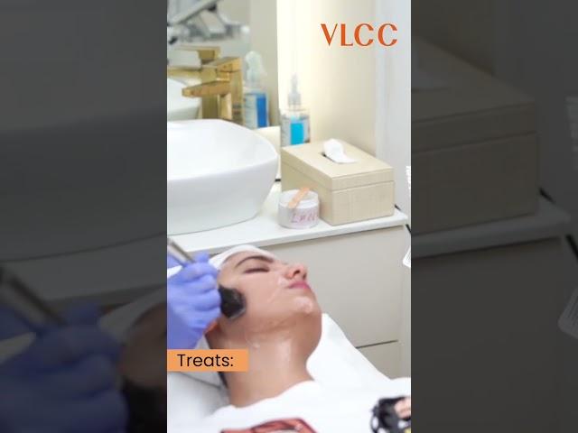 VLCC Forma Facial is a game-changer!