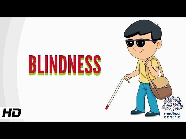 Blindness, Causes, Signs and Symptoms, Diagnosis and Treatment.