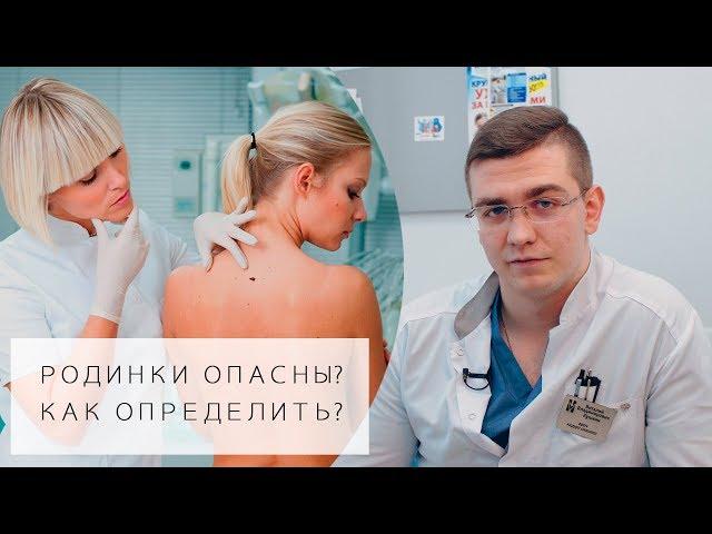 РОДИНКИ ОПАСНЫ? | 5 Простых способов определения | Какие родинки опасны?