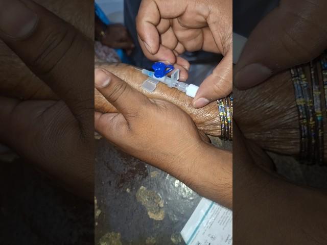 iv cannula proceed technique #part19