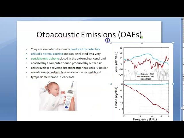 ENT OAE Otoacoustic Emissions Outer hair cells infant hearing test spontaneous evoked distorted