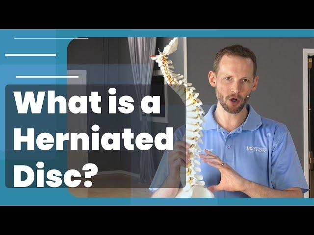 What Is A Herniated Disc - Symptoms, Causes, Treatments